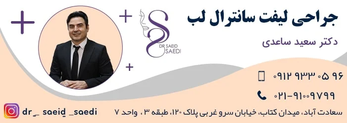 سانترال لب چیست و بررسی نکاتی راجبه آن