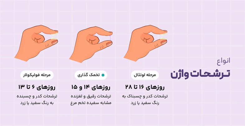 علل و انواع ترشحات واژن که باید بشناسید