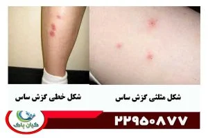روش های قطعی و موثر شرکت سمپاشی برای ساس : از سموم تا راهکارهای طبیعی