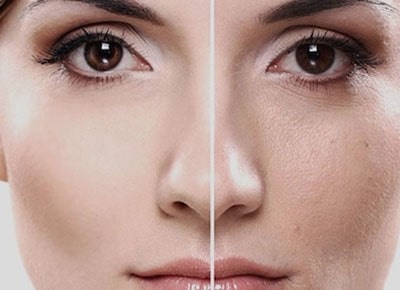 جوانسازی پوست با سلول بنیادی