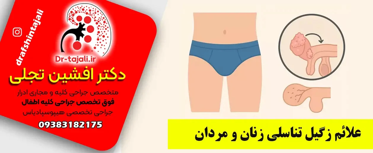 درمان زگیل تناسلی | زگیل تناسلی دکتر تجلی فوق تخصص درمان زگیل تناسلی اصفهان|کلینیک ارولوژی