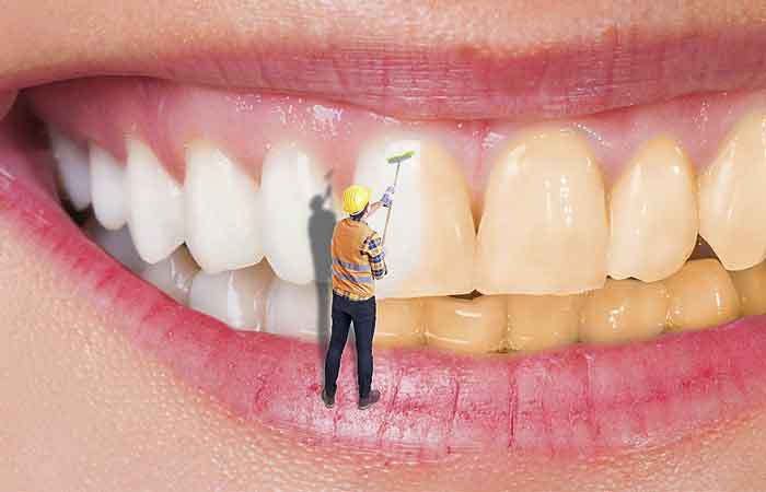 تبلیغ دندانپزشکی زیبایی