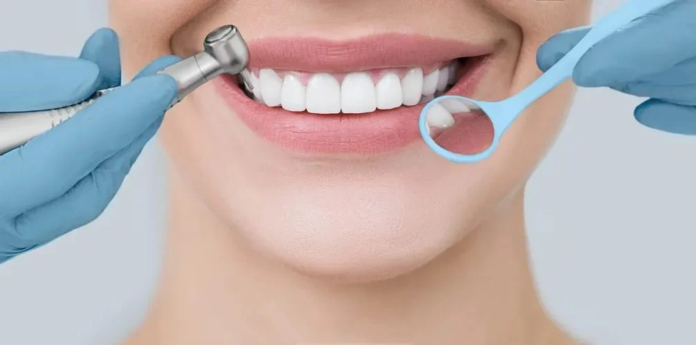 دندانپزشکی | لمینت دندان تبلیغ دندانپزشکی زیبایی